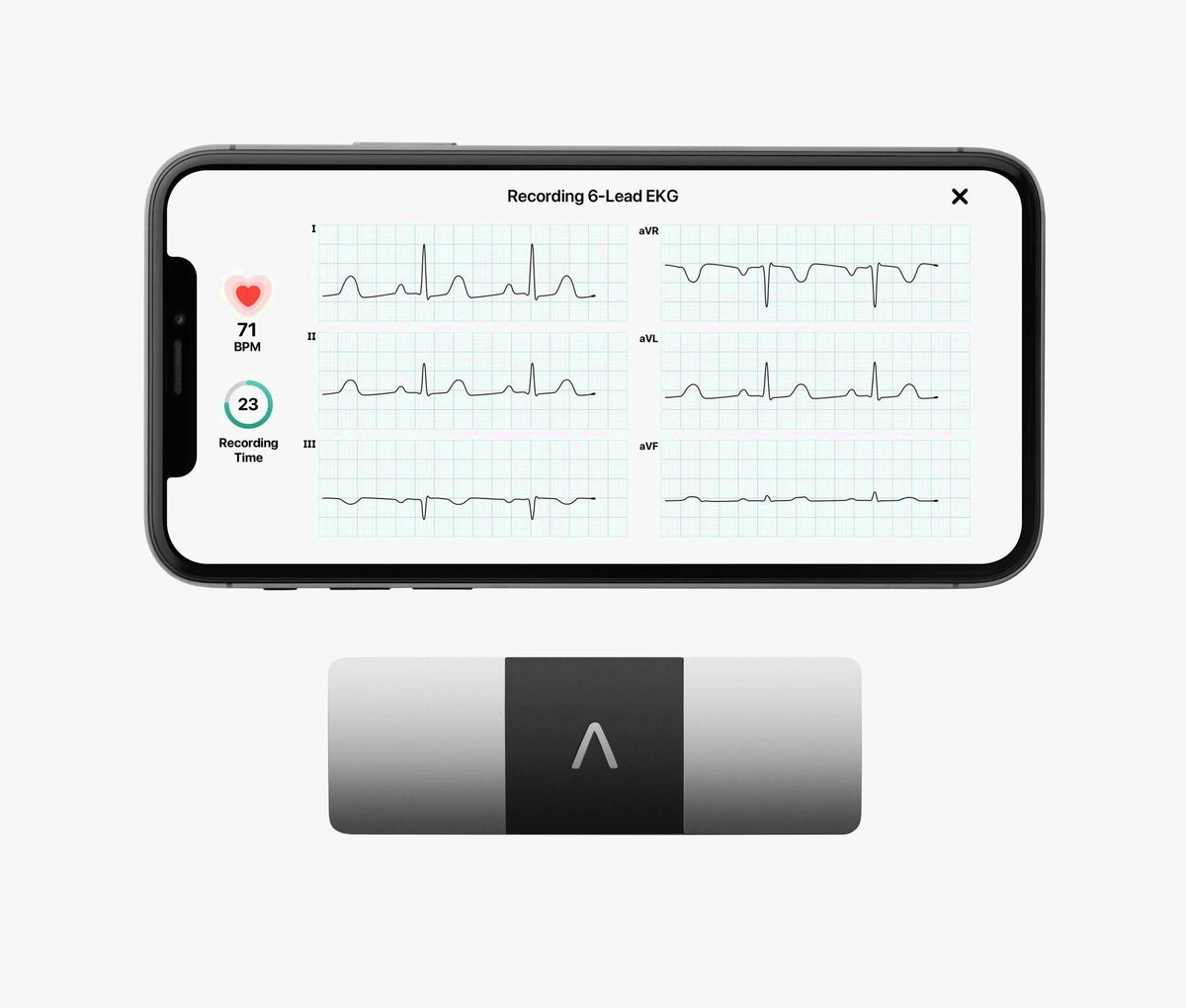AliveCor KardiaMobile 6L Personal EKG Monitor, Black - KM-6L-E