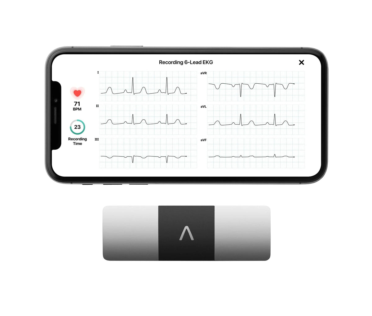 AliveCor KardiaMobile 6L Personal EKG Monitor, Black - KM-6L-E